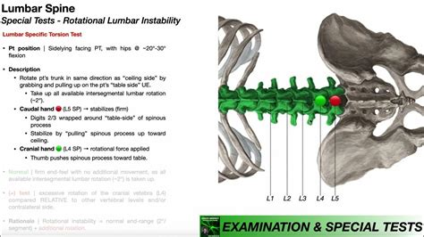 Specific Torsion Test for Lumbar Instability 